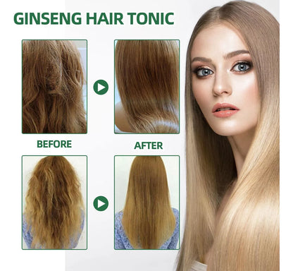 OUHOE - CRECIMIENTO DE CABELLO